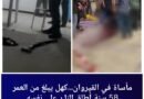كهل يطلق النار على نفسه من بندقية صيد