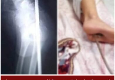 تدخل طبي عاجل ينقذ طفلًا من إصابة خطيرة بعد سقوطه من علو مرتفع بقليبية