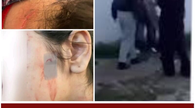 تونس: حادثة اعتداء بين تلميذات تثير القلق وتجدّد الدعوة لمكافحة العنف المدرسي