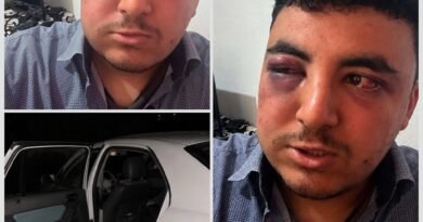 تلميذ يتحدث عن لحظات صعبة عاشها في حادثة أثارت الجدل